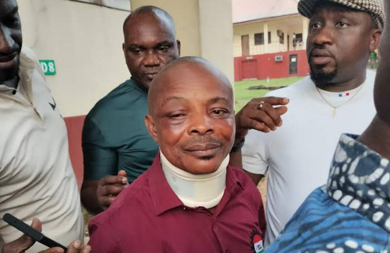 Assault on NLC President Joe Ajaero