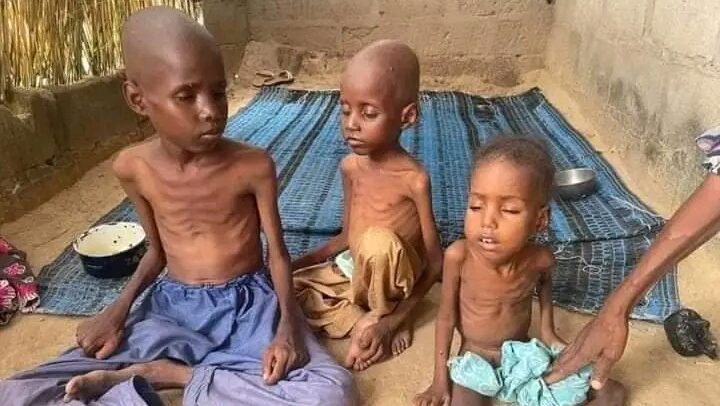Borno State Gov't responds to humanitarian crisis after viral post reveals family's malnutrition struggles