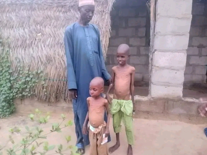 Borno State Gov't responds to humanitarian crisis after viral post reveals family's malnutrition struggles
