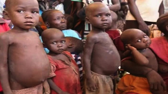 250,000 Zamfara Children Face Malnutrition Crisis