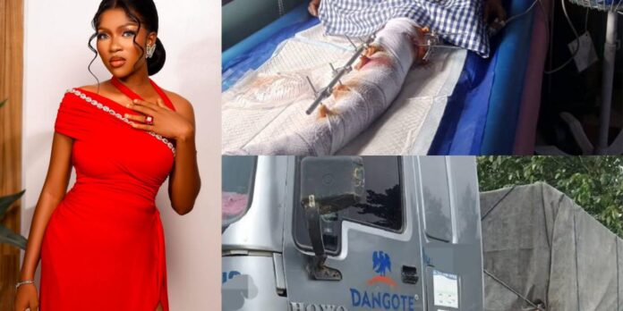 Outrage as BBNaija Phyna’s Sister Loses Leg After Dangote Truck Accident in Auchi