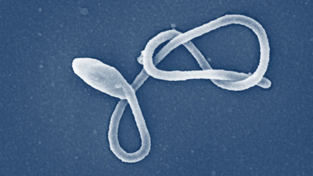 UN Allocates Fresh Funds as Ebola Threat Spreads