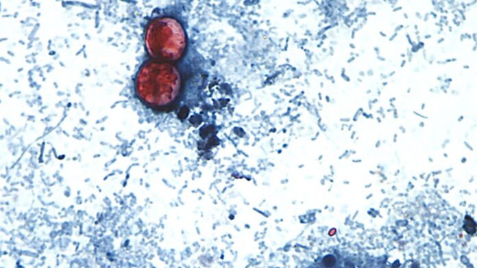 Parasitic diarrhoea outbreak rises to nearly 1,000 cases in Michigan
