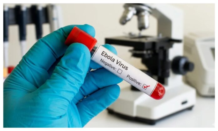 Ebola Virus: Symptoms, How It Spreads, Treatment and Prevention